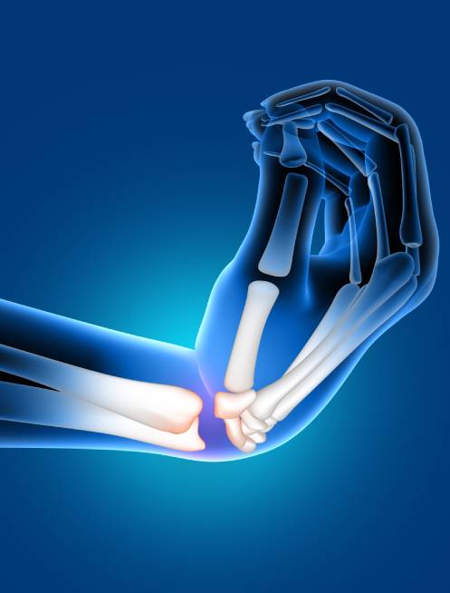 precio-de-consulta-de-infiltracion-articular-en-colima-centro-mexico.jpg